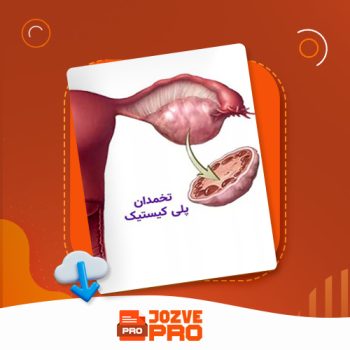 معرفی و دانلود مقاله پزشکی سندرم تخمدان پلی کیستیک جزوه پرو ۳ صفحه PDF 📙